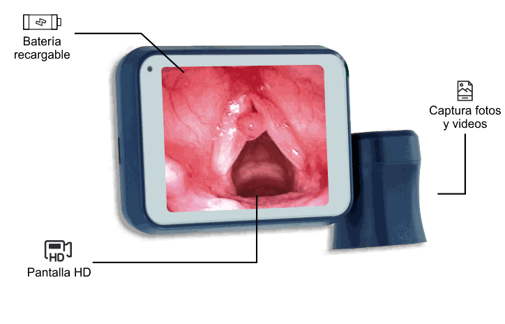 Videolaringoscopio OnFocus Lite